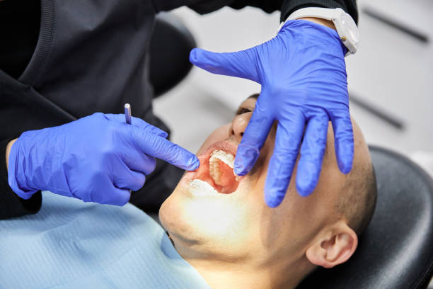 Best Emergency Root Canal Treatment in Weatherby Lake, MO